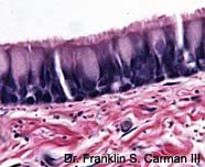 Image of ciliated columnar eithileium cells