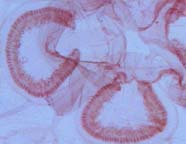 Image of gastric pouch of jellyfish
