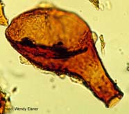 Image of a microfossil (rotifer)