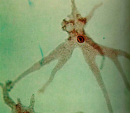 Image of amoeba w. pseudopodia