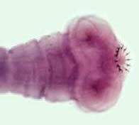 Image of tapeworm scolex