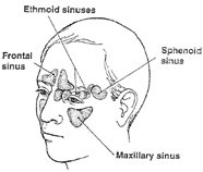 Graphic of sinuses in human head