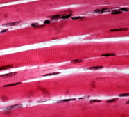 Image of skeletal muscle cells