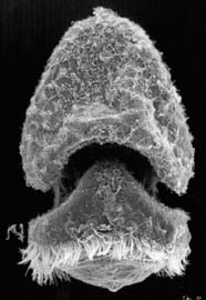 Image of tornaria larva