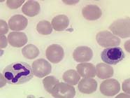 Image of blood cells