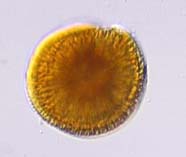 Image of toxic dinoflagellate <i>Gambierdiscus toxicus</i>