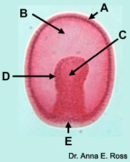 Image of a gastrula