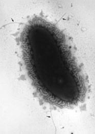Image of a <i>Vibrio</i>